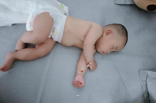 广东宝宝脸上有白色斑块 广东宝宝脸上有白色斑块